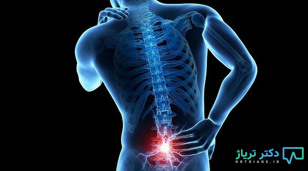 دردد دنبالچه علت درد دنبالچه درمان درد دنبالچه با ورزش دکتر امیر عباس متولی پزشک داخلی، ارتوپدی، اصلاح ستون فقرات، درمان غیر جراحی