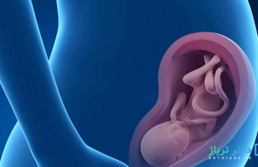 کمر دردها و بدفرمی های بعد از زایمان دکتر امیر عباس متولی پزشک داخلی، ارتوپدی، اصلاح ستون فقرات، درمان غیر جراحی